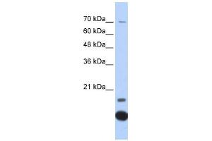 Thioredoxin 2 antibody used at 1 ug/ml to detect target protein. (TXN2 antibody  (Middle Region))