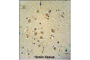 Immunohistochemistry (Paraffin-embedded Sections) (IHC (p)) image for anti-Zic Family Member 3 (ZIC3) (AA 239-267) antibody (ABIN650719)