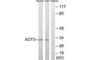 Western Blotting (WB) image for anti-Solute Carrier Family 25 (Mitochondrial Carrier, Adenine Nucleotide Translocator), Member 6 (SLC25A6) (Internal Region) antibody (ABIN1850696) (SLC25A6 antibody  (Internal Region))