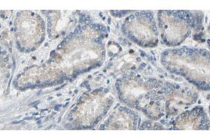 ABIN6269324 at 1/100 staining Human prostate tissue by IHC-P. (LIPE antibody  (Internal Region))