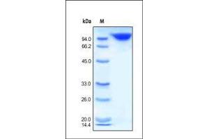 DPP4 Protein (AA 29-766) (Fc Tag)