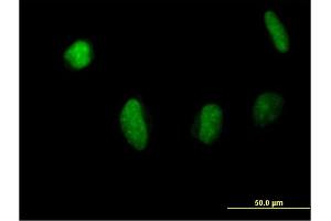 Immunofluorescence of purified MaxPab antibody to MSL3L1 on HeLa cell. (MSL3 antibody  (AA 1-521))