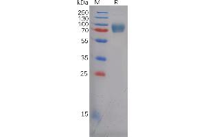 SDS-PAGE (SDS) image for EPH Receptor A5 (EPHA5) (AA 25-573) protein (His tag) (ABIN7092771)