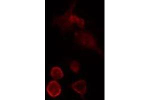 ABIN6275724 staining  HeLa cells by IF/ICC. (MED27 antibody  (Internal Region))
