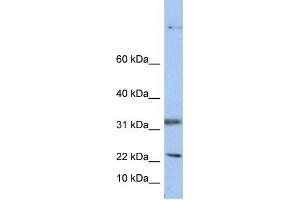 Western Blotting (WB) image for anti-15 KDa Selenoprotein (SEP15) antibody (ABIN2459187) (Sep 15 antibody)