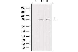 Western blot analysis of extracts from various samples, using HGFAC Antibody. (HGFA antibody  (C-Term))