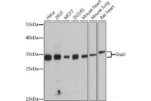 Western blot analysis of extracts of various cell lines using Snail Polyclonal Antibody at dilution of 1:1000. (SNAIL antibody)