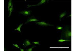 Immunofluorescence (IF) image for anti-Fanconi Anemia, Complementation Group L (FANCL) (AA 1-375) antibody (ABIN949415)