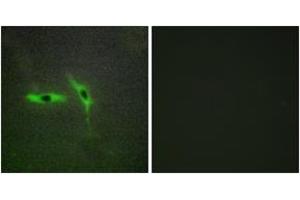 Immunofluorescence analysis of HepG2 cells, using TNFRSF6B Antibody. (TNFRSF6B antibody  (AA 251-300))