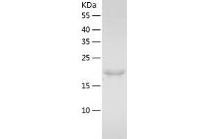 Western Blotting (WB) image for HLA-DR-gamma (CD74) (AA 73-232) protein (His tag) (ABIN7123354) (CD74 Protein (AA 73-232) (His tag))