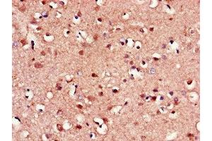 Immunohistochemistry of paraffin-embedded human brain tissue using ABIN7153193 at dilution of 1:100 (FZD8 antibody  (AA 55-233))