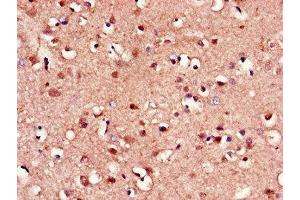Immunohistochemistry of paraffin-embedded human brain tissue using ABIN7153193 at dilution of 1:100