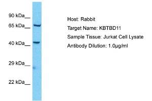 Host: Rabbit Target Name: KBTBD11 Sample Type: Jurkat Whole Cell lysates Antibody Dilution: 1. (KBTBD11 antibody  (Middle Region))