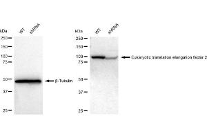 Western blotting analysis using Eukaryotic translation elongation factor 2 antibody (ABIN7798502).
