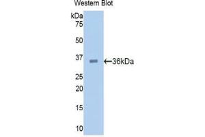 Western blot analysis of the recombinant protein. (PCSK9 antibody  (AA 156-461))