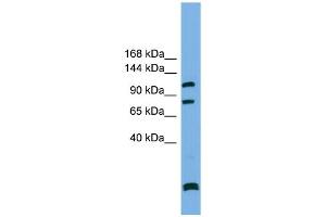 WB Suggested Anti-PPP6R1  Antibody Titration: 0. (SAPS1 antibody  (N-Term))