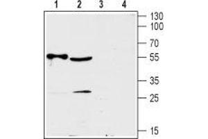 Western blot analysis of rat heart (lanes 1 and 3) and mouse brain (lanes 2 and 4) lysates:  - 1,2. (SLC29A2 antibody  (3rd Intracellular Loop))