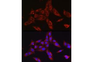 Immunofluorescence analysis of U-2 OS cells using Furin Rabbit pAb (ABIN6127933, ABIN6140815, ABIN6140817 and ABIN6223322) at dilution of 1:150 (40x lens). (FURIN antibody  (AA 120-370))