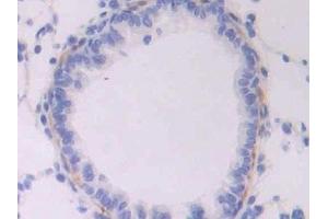 Detection of ENG in Rat Lung Tissue using Polyclonal Antibody to Endoglin (ENG)