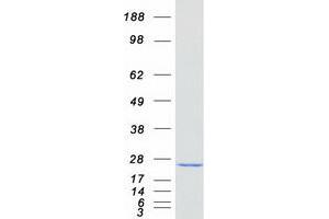 Validation with Western Blot
