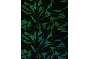 Immunofluorescence analysis of L929 cells using TIMM8B Polyclonal Antibody (ABIN7270928) at dilution of 1:100 (40x lens). (TIMM8B antibody  (AA 16-98))