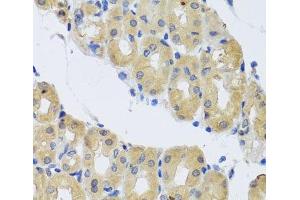 Immunohistochemistry of paraffin-embedded Human stomach using DYNC1I1 Polyclonal Antibody at dilution of 1:100 (40x lens). (DYNC1I1 antibody)