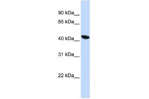 TMEM117 antibody used at 1 ug/ml to detect target protein. (TMEM117 antibody  (Middle Region))
