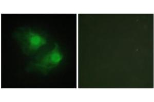 Immunofluorescence analysis of HeLa cells, using LIMK2 antibody. (LIMK2 antibody  (Internal Region))