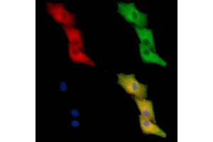 ABIN7096225 and ABIN7100287 staining  cells by IF/ICC. (DSCR3 antibody)