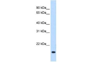 WB Suggested Anti-Rgs2 Antibody Titration:  1. (RGS2 antibody  (Middle Region))