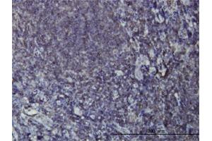Immunoperoxidase of monoclonal antibody to EPHB3 on formalin-fixed paraffin-embedded human tonsil. (EPH Receptor B3 antibody  (AA 899-997))