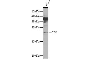 Western blot analysis of extracts of MCF7 cells, using CGB Rabbit pAb (ABIN6129262, ABIN6138471, ABIN6138472 and ABIN6216035) at 1:1000 dilution. (CGB antibody  (AA 21-165))