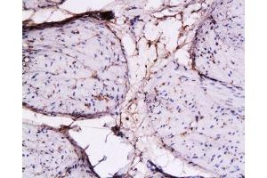 Immunohistochemistry (Paraffin-embedded Sections) (IHC (p)) image for anti-Collagen, Type I (COL1) (AA 1321-1400) antibody (ABIN670386)