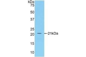 Western Blotting (WB) image for anti-Tumor Necrosis Factor (Ligand) Superfamily, Member 13b (TNFSF13B) (AA 113-283) antibody (ABIN7433933)