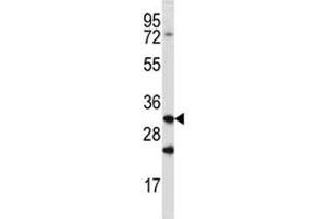 Cathepsin Q antibody western blot analysis in mouse spleen tissue lysate (Cathepsin Q antibody  (AA 192-221))