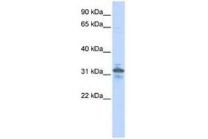 Image no. 1 for anti-Ribose 5-Phosphate Isomerase A (RPIA) (N-Term) antibody (ABIN6741327)