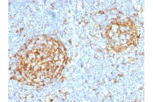 Formalin-fixed, paraffin-embedded human Lymph Node stained with CD14 Mouse Monoclonal Antibody (LPSR/2397). (CD14 antibody  (AA 25-148))