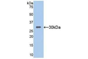 Detection of Recombinant SIRT1, Mouse using Polyclonal Antibody to Sirtuin 1 (SIRT1) (SIRT1 antibody  (AA 236-490))