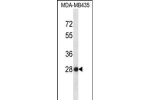 SNRPB2 Antibody (N-term) (ABIN656315 and ABIN2845618) western blot analysis in MDA-M cell line lysates (35 μg/lane). (SNRPB2 antibody  (N-Term))