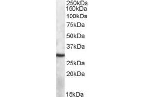 ABIN334347 (1µg/ml) staining of Mouse Spleen lysate (35µg protein in RIPA buffer). (APOBEC1 antibody  (Internal Region))