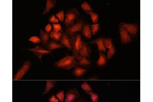 Immunofluorescence analysis of U-2 OS cells using STAM2 Polyclonal Antibody at dilution of 1:100. (STAM2 antibody)
