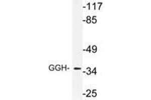Western blot (WB) analysis of GGH antibody in extracts from RAW264. (GGH antibody)
