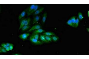 Immunofluorescent analysis of Hela cells using ABIN7156336 at dilution of 1:100 and Alexa Fluor 488-congugated AffiniPure Goat Anti-Rabbit IgG(H+L) (IRS2 antibody  (AA 766-1001))