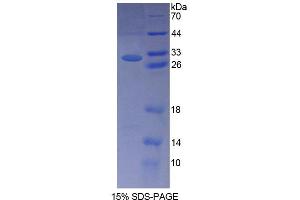 Image no. 1 for Nephronophthisis 2, Infantile (NPHP2) (AA 1-237) protein (T7 tag,His tag) (ABIN6238662)