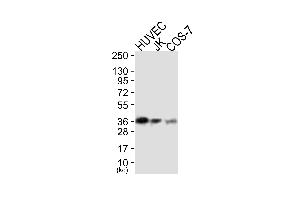 Western blot analysis of extracts from HUVEC cells (Lane 1), JK cells (Lane 2) and COS-7 cells (Lane 3), using MCL1 Antibody. (MCL-1 antibody)