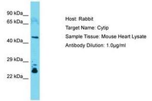 Image no. 1 for anti-Cytohesin 1 Interacting Protein (CYTIP) (C-Term) antibody (ABIN6749905) (CYTIP antibody  (C-Term))