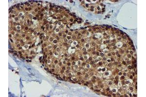 Image no. 9 for anti-Metalloproteinase Inhibitor 2 (TIMP2) antibody (ABIN1501393)