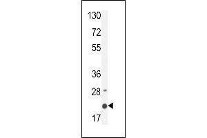 M4A4A Antibody (N-term) (ABIN654770 and ABIN2844450) western blot analysis in MDA-M cell line lysates (35 μg/lane). (MS4A4A antibody  (N-Term))