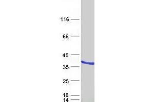 Validation with Western Blot