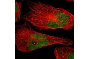 Immunofluorescent staining of human cell line U-2 OS with APEX1 polyclonal antibody  at 4 ug/ml shows positivity in nucleus.